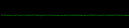 EKG — Asystole